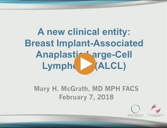 Breast Implant Associated Anaplastic Large Cell Lymphoma BIA ALCL 