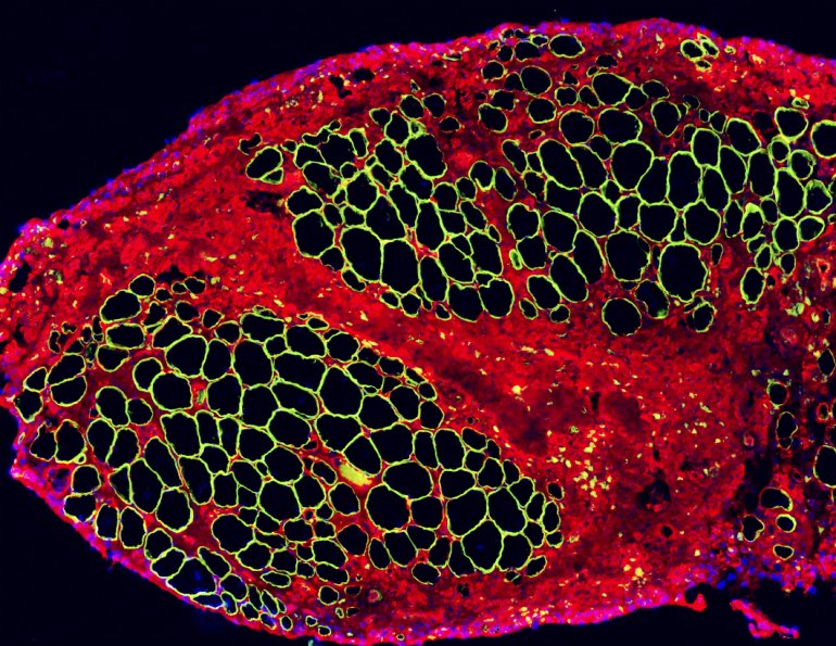 Regenerating Muscle